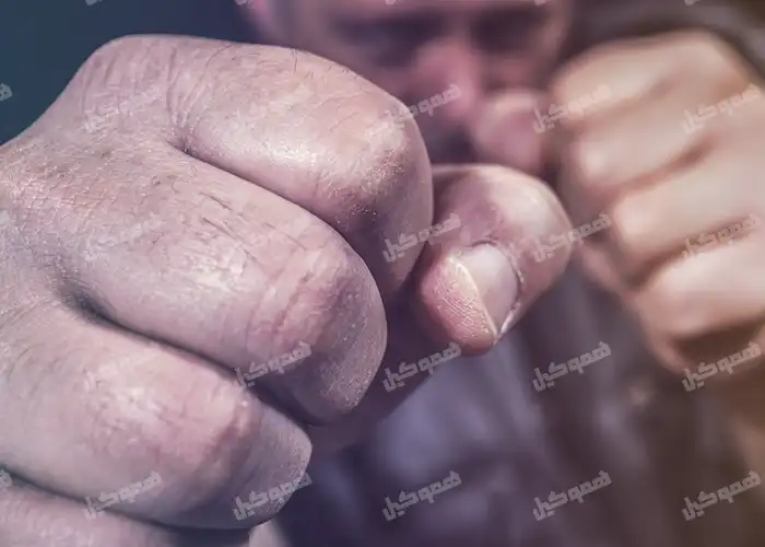 مقاله کامل ضرب و جرح و مجازات آن